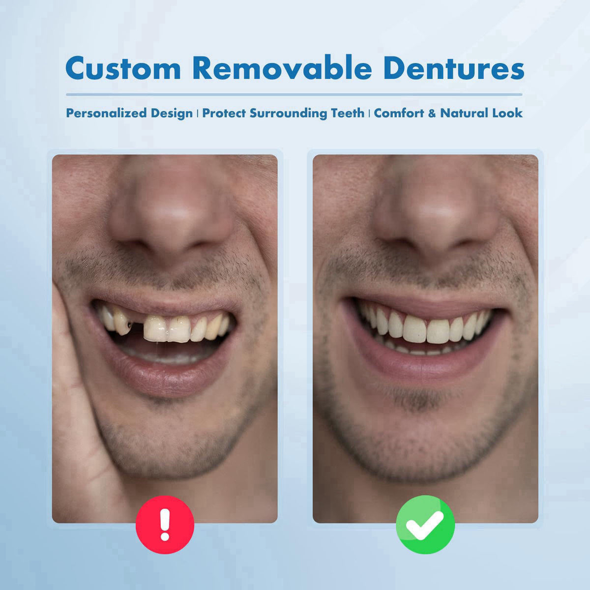 Qiivosm Custom Removable Dentures – Set for Tooth Replacement (1 Tooth) – packaging and label
