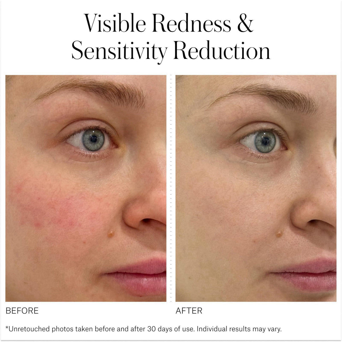 INSTYTUTUM SuperBiotic Face Cream - Ceramide Skin Barrier Moisturizer – packaging and label
