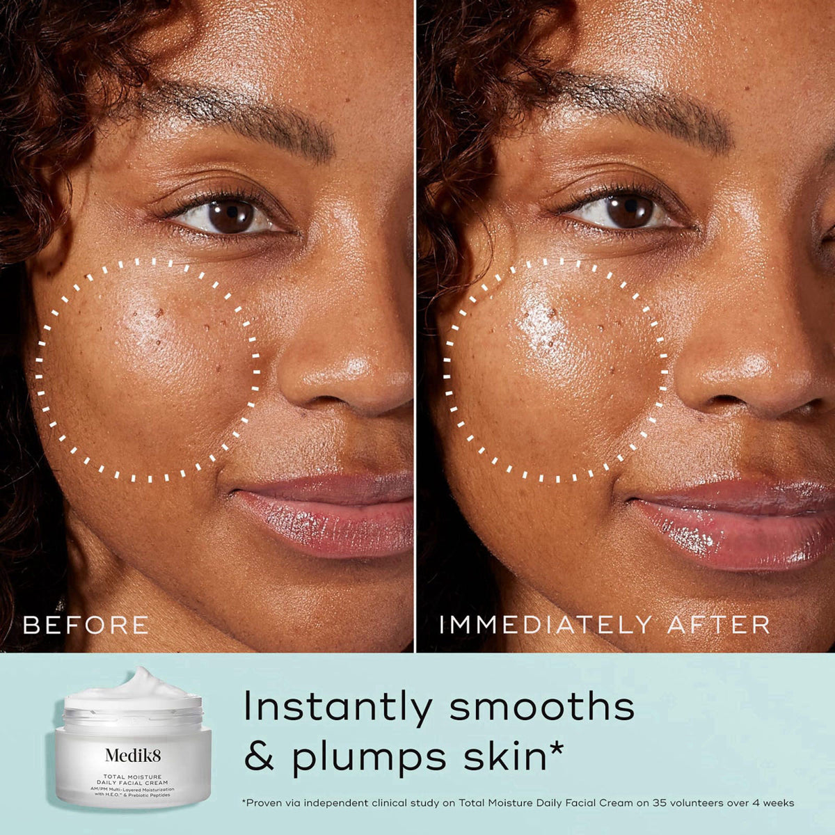 Medik8 Total Moisture Daily Facial Cream - Hydrating Peptide Face Moisturizer with Hyaluronic Acid - Face Cream Supports