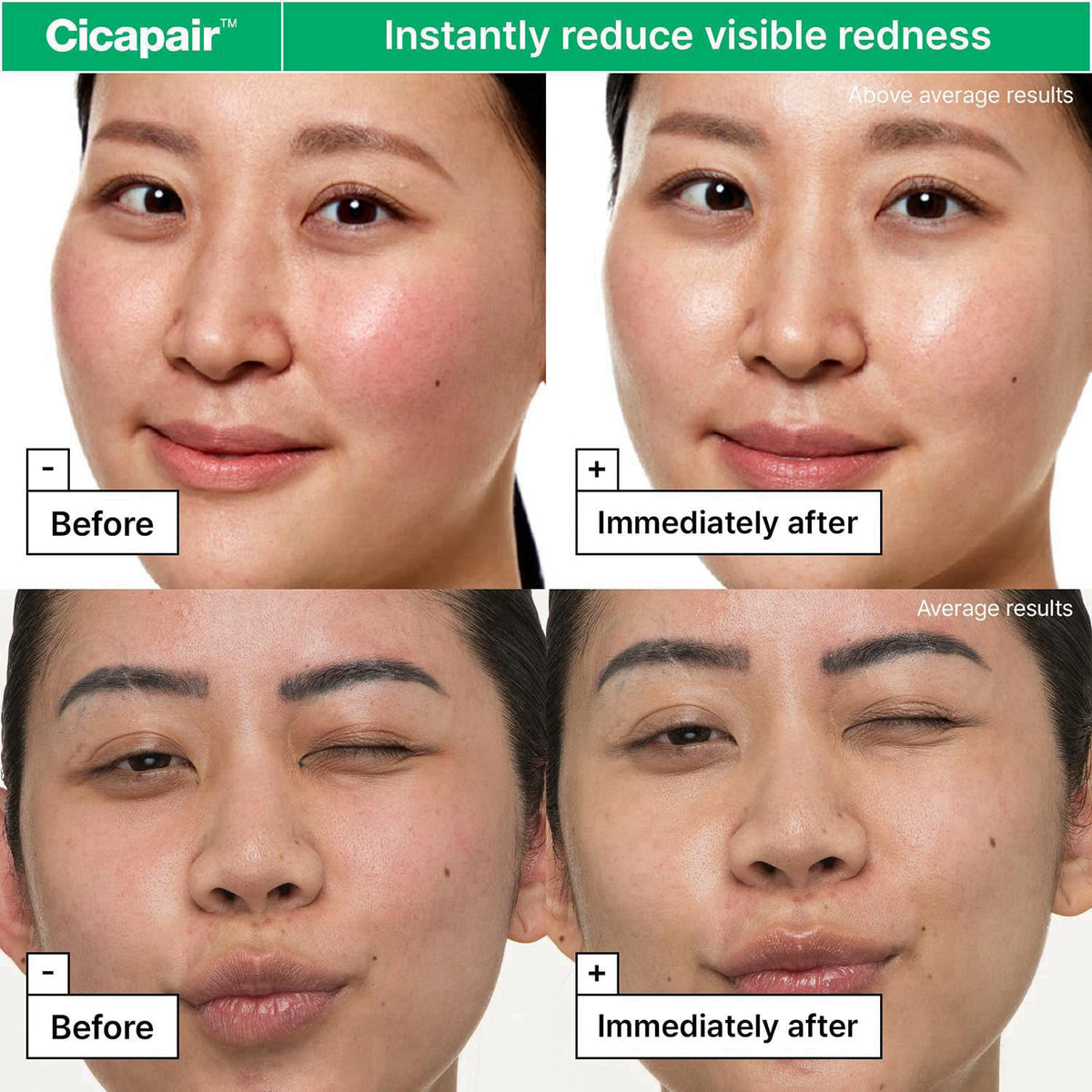 Dr.Jart+ Cicapair Sensitive Skin Korean Face Moisturizer for Redness and Barrier Repair with Centella Asiatica | Korean 