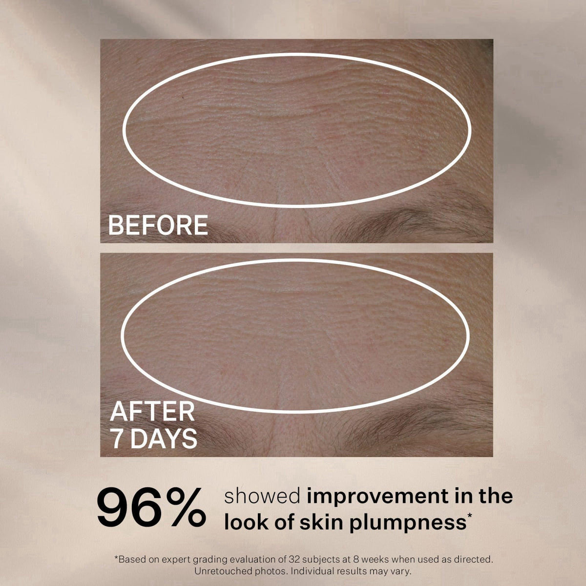 StriVectin Anti-Wrinkle Peptide Plump Line Filling Bounce Face Serum with Ceramides & Peptides for Firm Skin and Less Wr