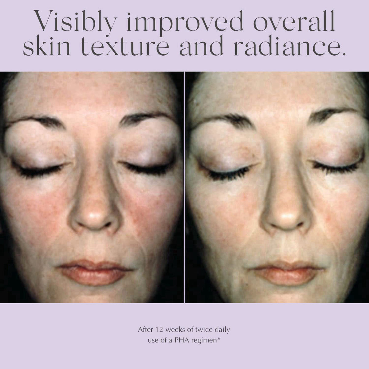 EXUVIANCE Overnight Transformation Complex Hydrating Night Cream with Hyaluronic Acid, Non-Comedogenic 50 g. – back view