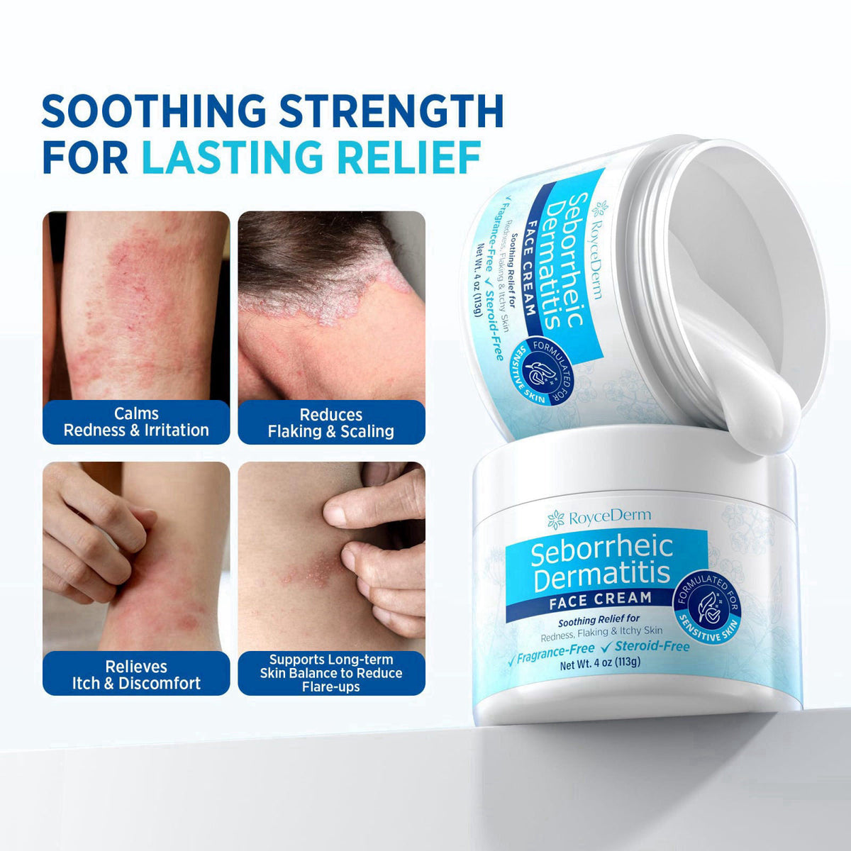 Roycederm Seborrheic Dermatitis Face Cream – Steroid-Free Moisturizer for Redness, Flaking & Sensitive Skin – Face, Scal