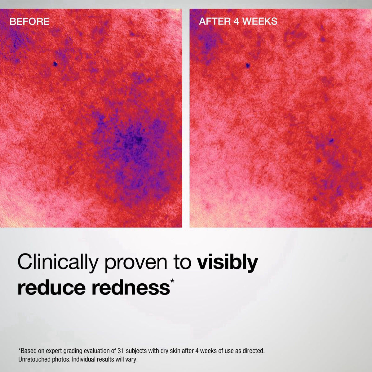 StriVectin Barrier Restore + Soothing Milky Face Mist with Ceramides + Hyaluronic Acid – alternate angle