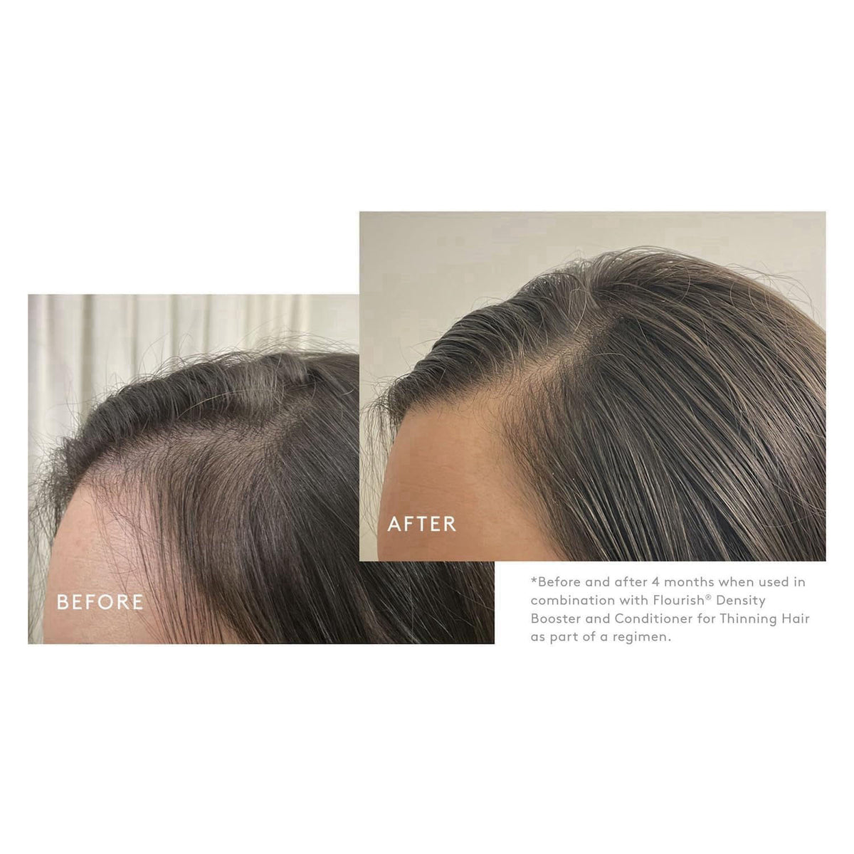 VIRTUE Flourish Sulfate Free Shampoo for Thinning Hair, Volumizing Hair Growth Product, Detoxifies and Repairs, Color Sa