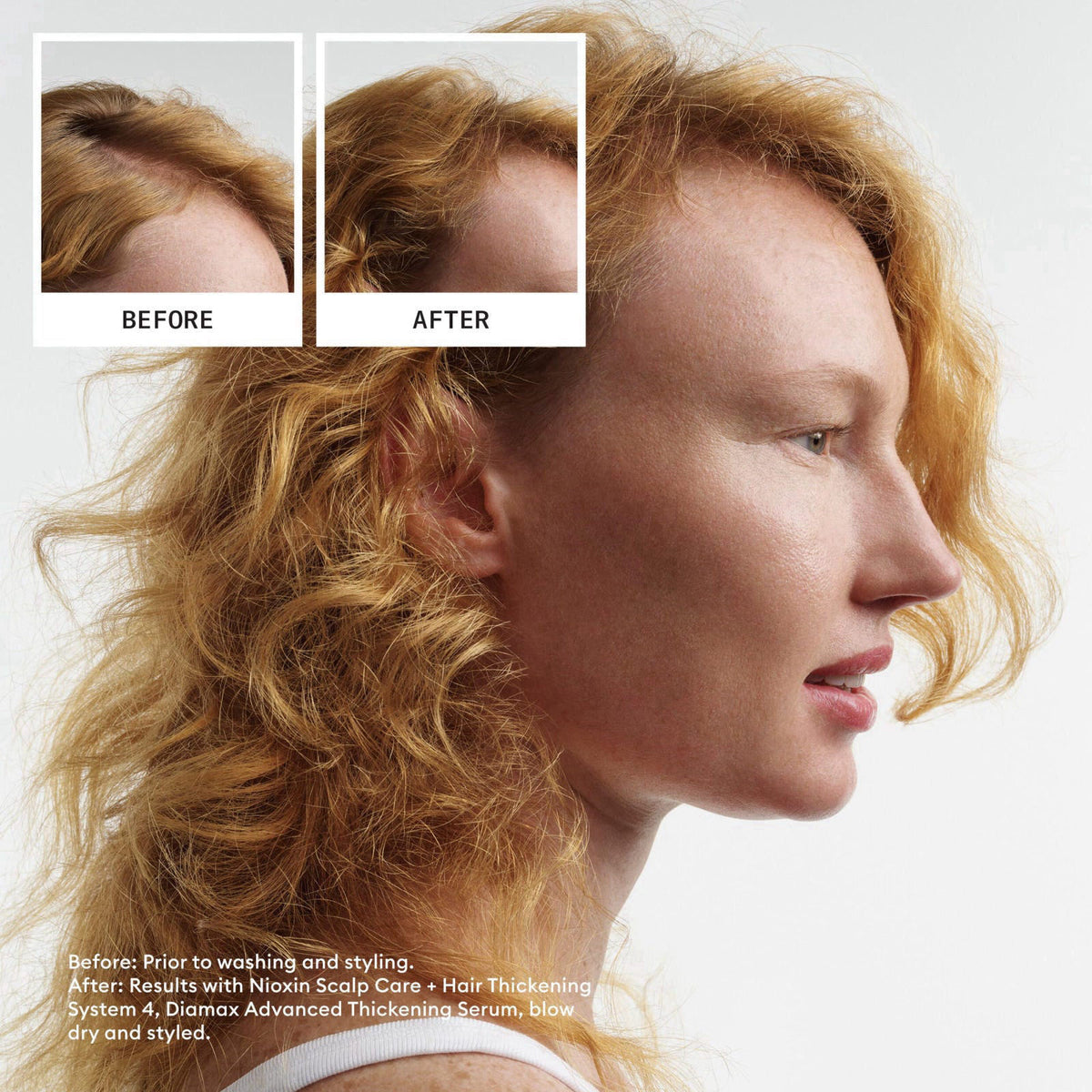 NIOXIN System Kits | Scalp + Hair Thickening | 1 Month Supply – close-up detail