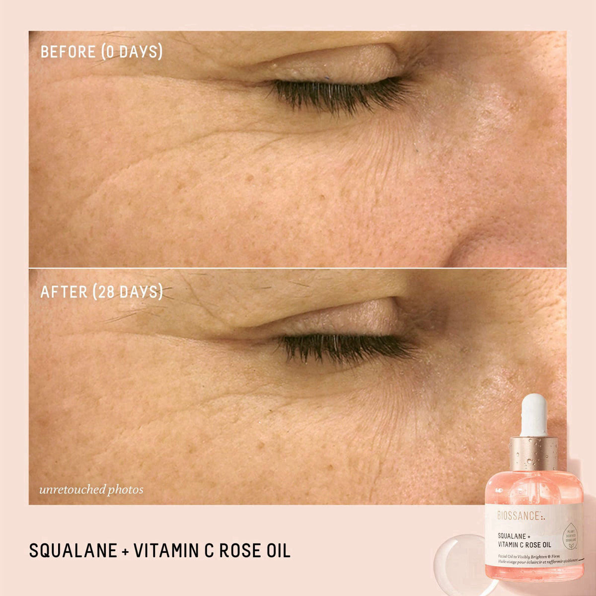 BIOSSANCE Rapid Radiance Set - Clean Skincare Gift for Glowing Skin – alternate angle
