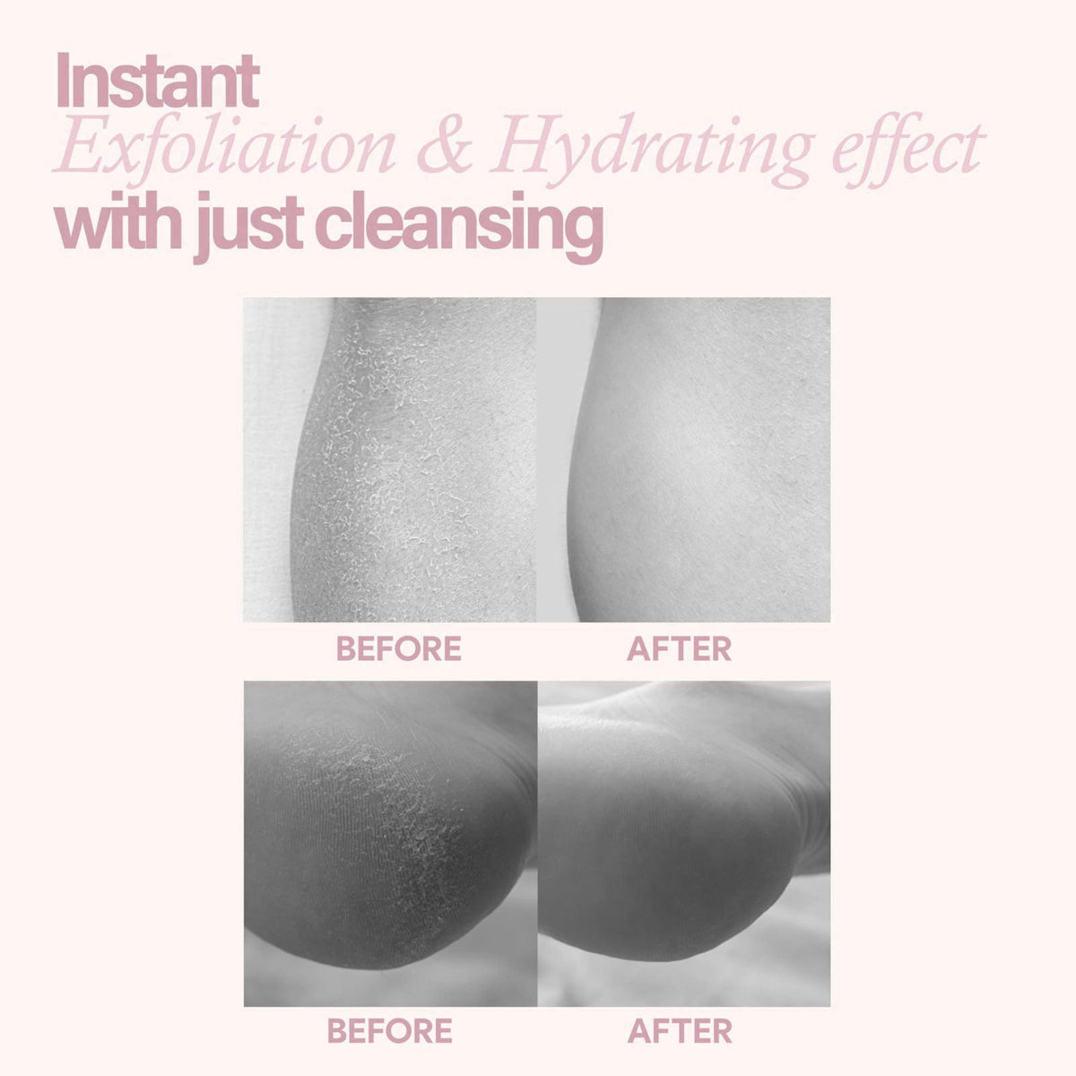 FLANER Snowberry Sorbet Glow Body Scrub – Gentle Exfoliating Scrub, Brightening & Hydrating Formula with 9,800ppm of Whi