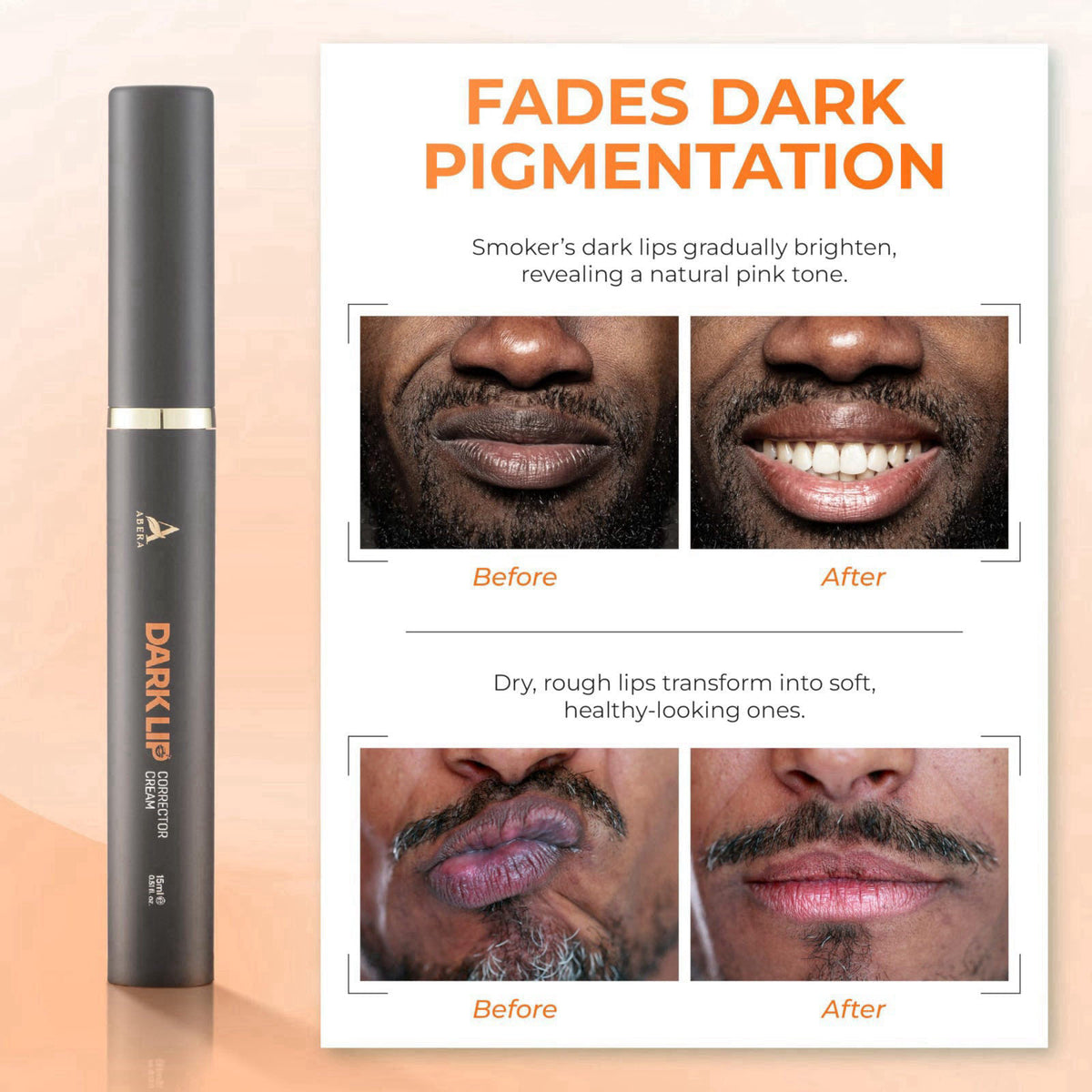 ABERA Dark Lip Corrector Cream for Dark Lips, Uneven Tone & Fordyce Spots – full view, size 1 Pack