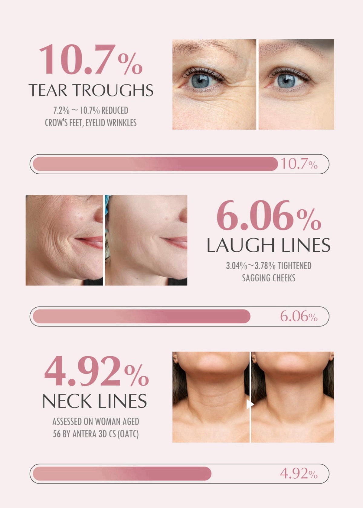 KAHI Eye Balm Stick - Moisturizing Balm for Dark Circles & Fine Lines – alternate angle