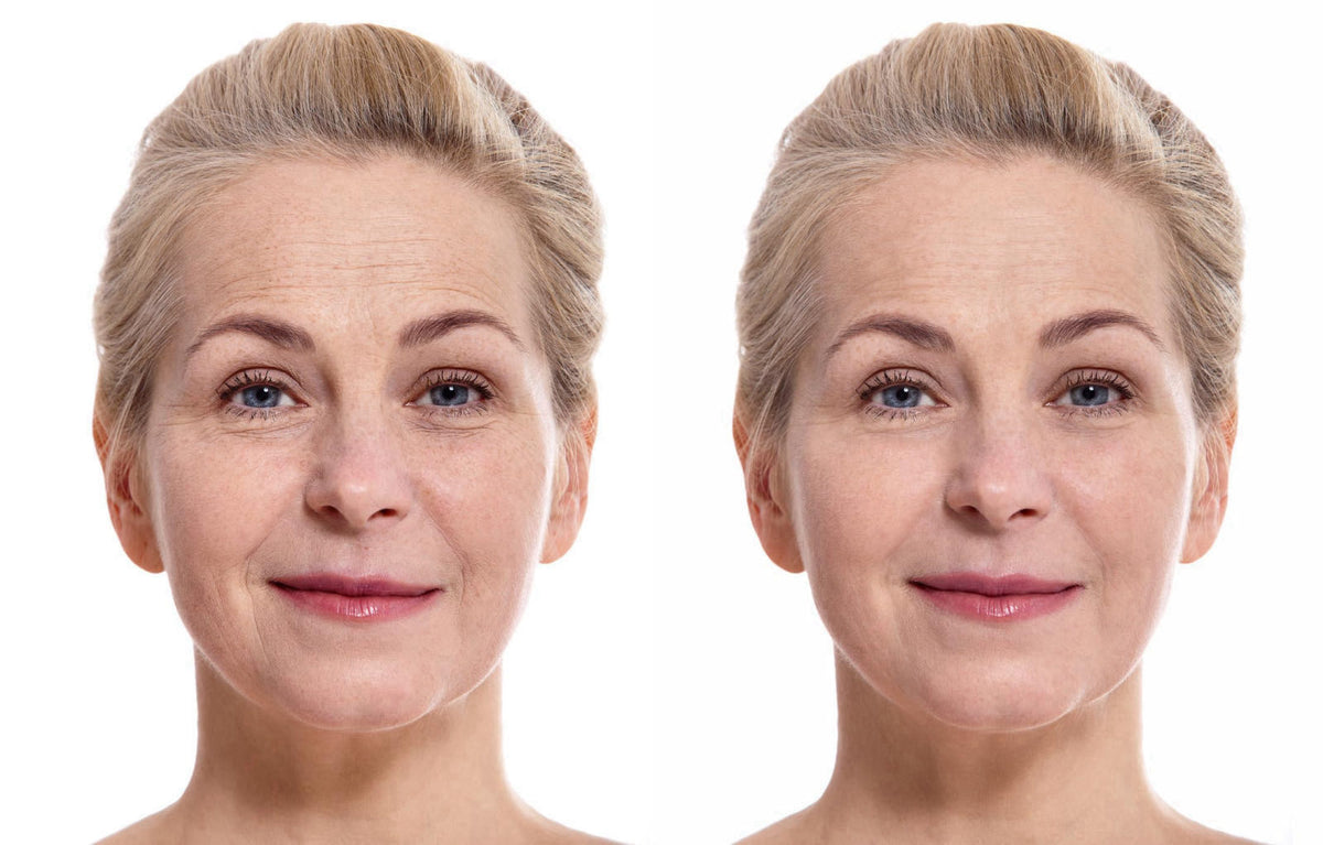 Precision Skin RX Vitality Precision Skin Micro-Exfoliating Scrub – full view