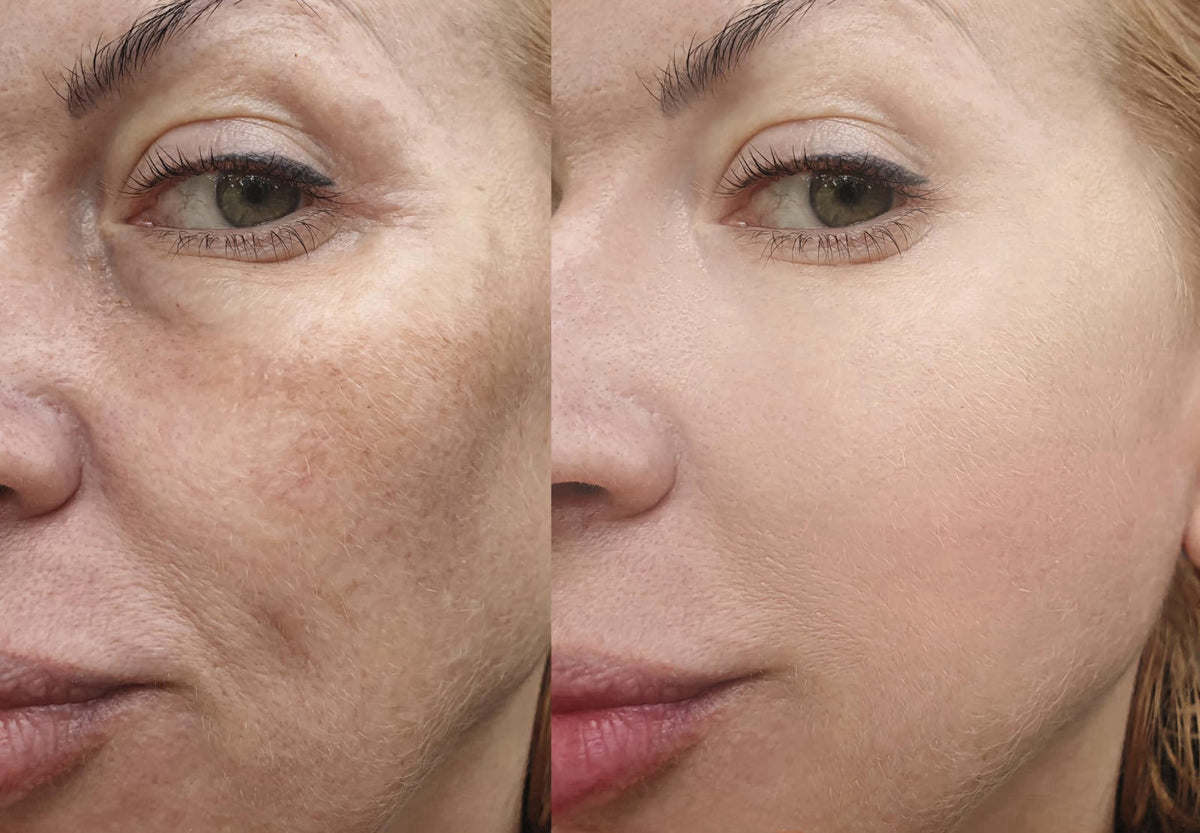 Precision Skin RX Vitality Precision Skin Micro-Exfoliating Scrub – back view and specifications