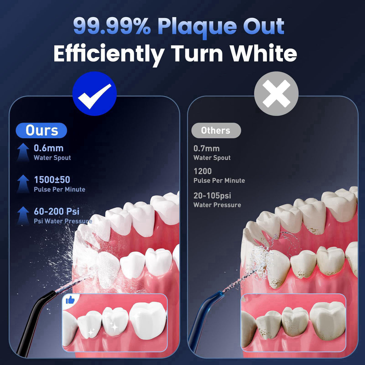 Reure Cordless Water Flosser for Teeth Cleaning, Gums & Braces, 5 Cleaning Modes with DIY Mode, 6 Jet Tips, 320ml Water 