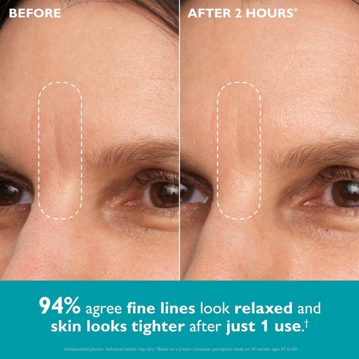 Peter Thomas Roth | Peptide Skinjection™ ​Peptide-Infused Face & Eye Tape | Face Tape For Wrinkles and Aging Skin | Pept