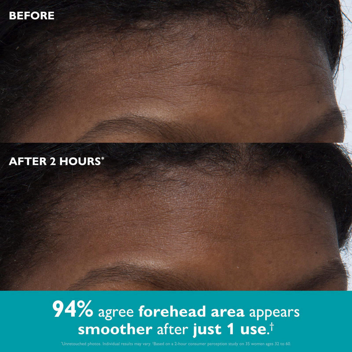Peter Thomas Roth | Peptide Skinjection™ ​Peptide-Infused Face & Eye Tape | Face Tape For Wrinkles and Aging Skin | Pept