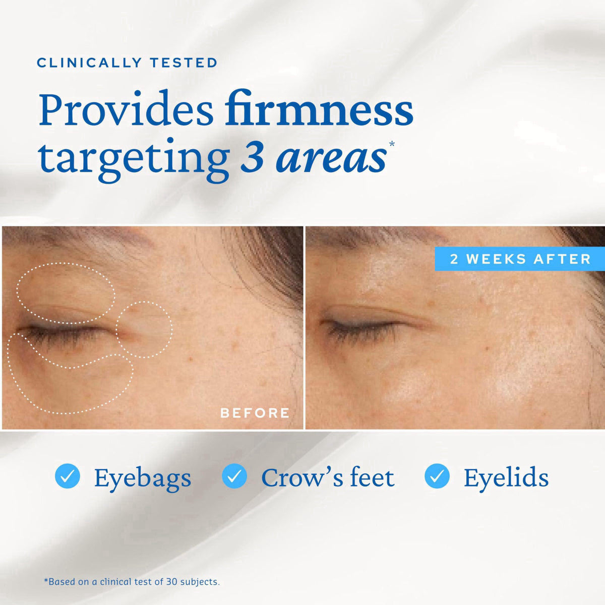 belif Peptide Eye Bomb Anti-Aging Eye Cream for Crow's Feet, 0.84 fl.oz – full view