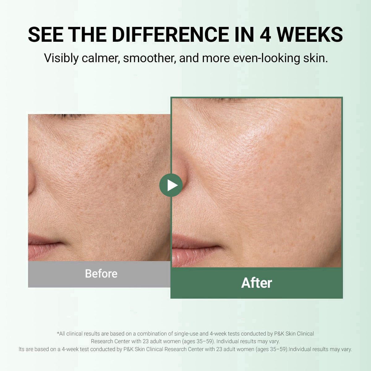 DA EFFECT Post Care Balm (30ml), Post Laser Recovery Cream for Skin Redness – packaging and label
