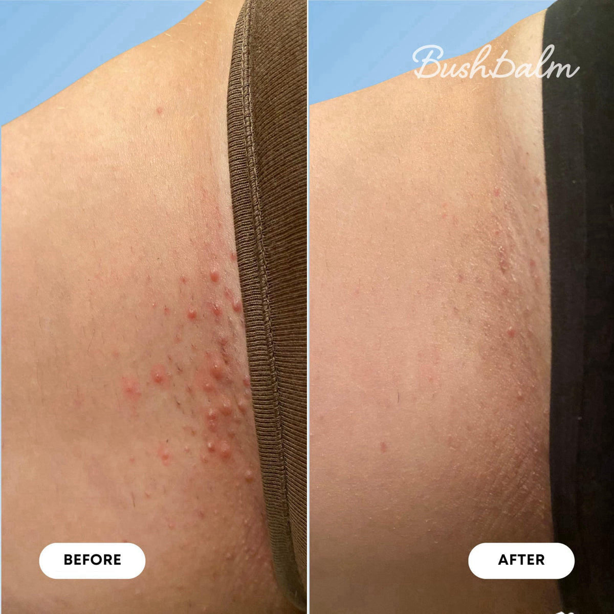 Bushbalm Ingrown Hair & Razor Bumps Oil - Nude, 30ml – back view and specifications