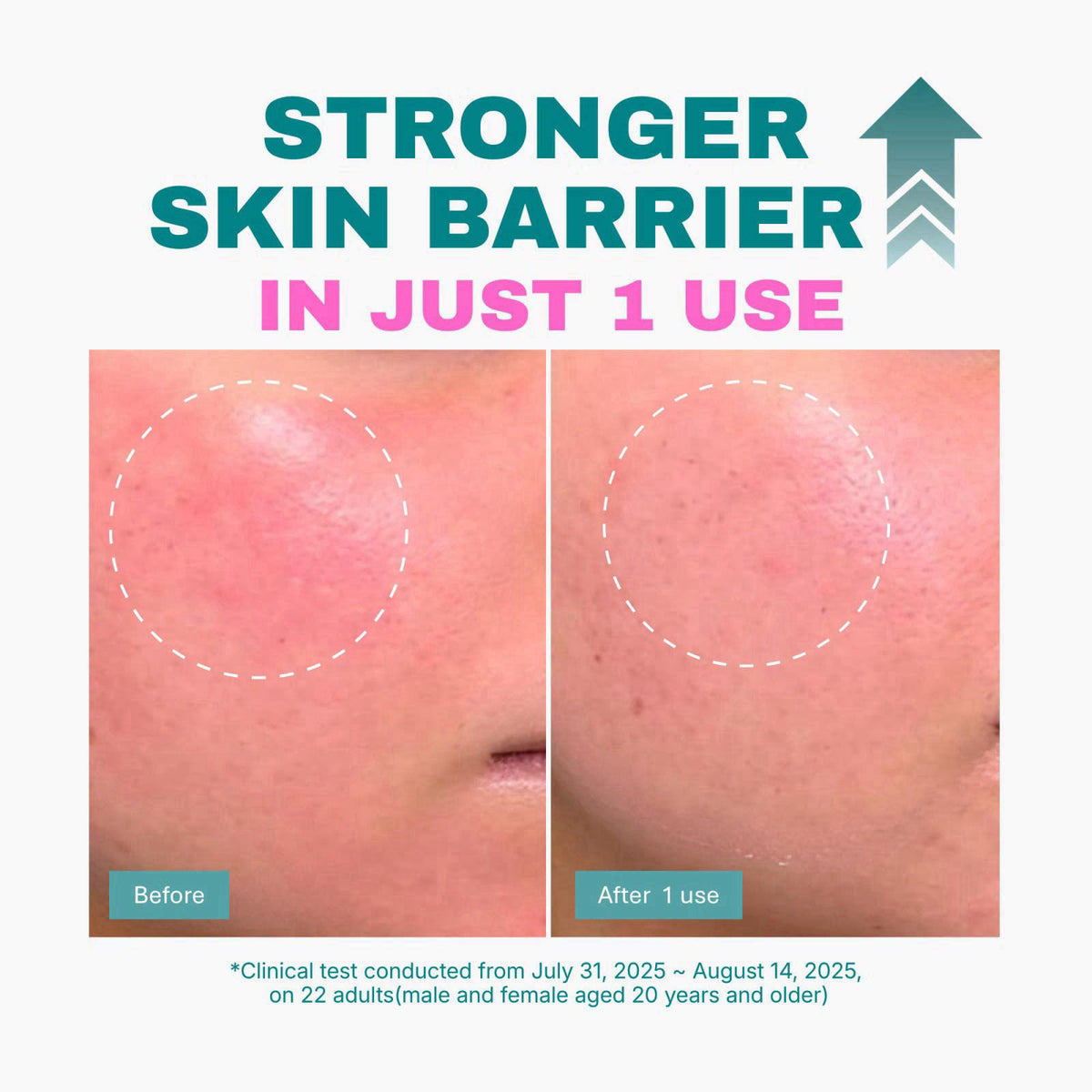 DEEPERCENT Barrier Repair Night Cream for Dry, Blemish-Prone Skin – alternate angle