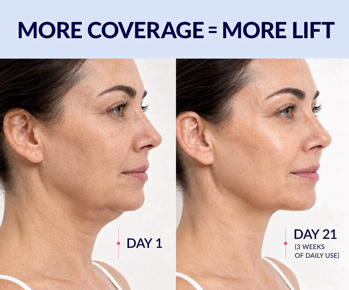 Stylia MaxiLift V-Line Lifting Collagen Face Mask - Double Chin Strap - Jawline Shaper & Face Tightener - Neck Firming a