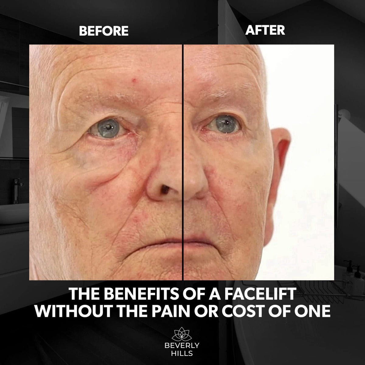 Beverly Hills Mens Instant Facelift and Eye Serum Treatment for Dark Circles, Puffy Eyes, and Wrinkles – close-up detail