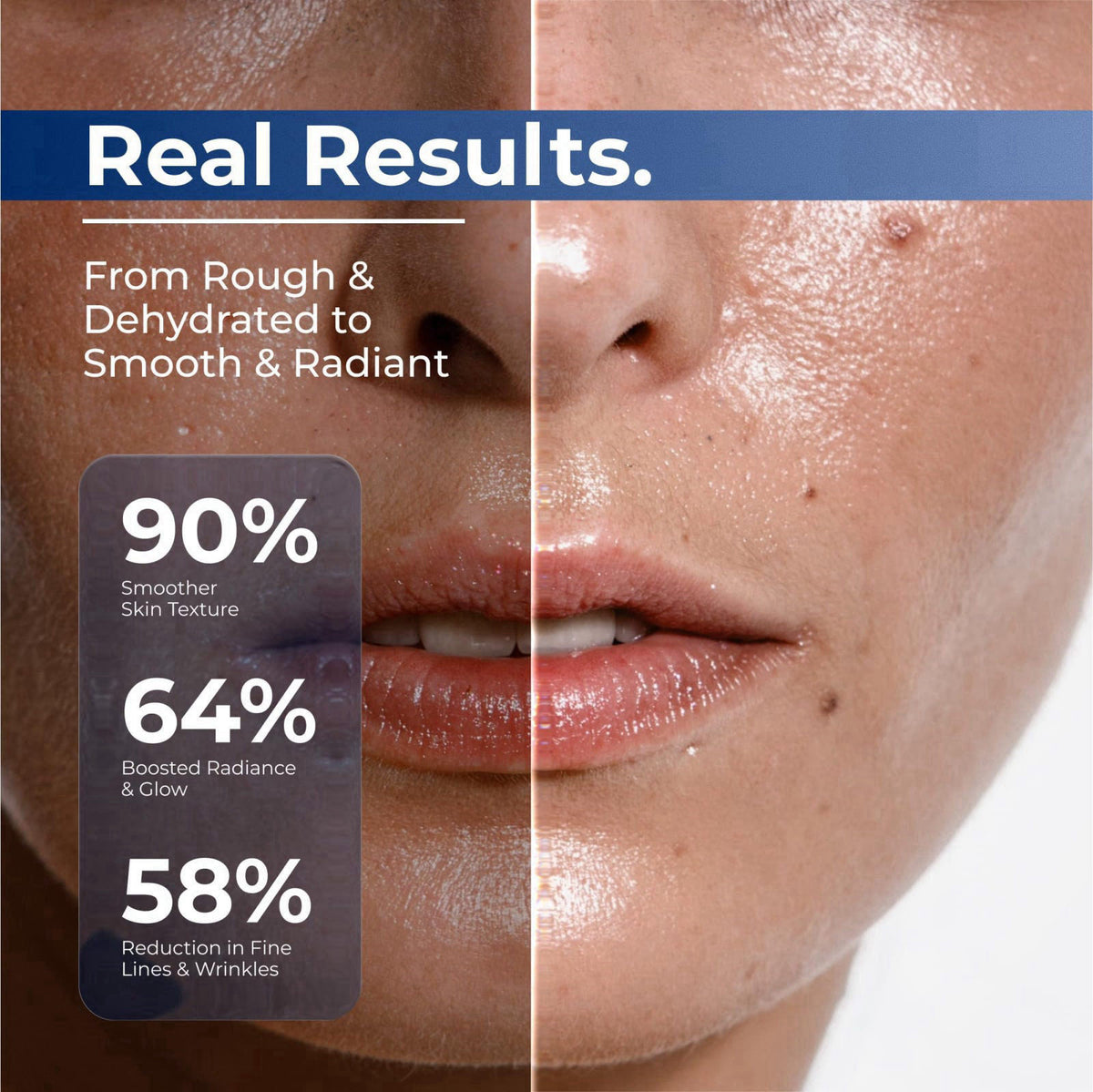 TURMSKIN® Hyaluronic Acid Serum Ampoules [ULTRA HYDRATING VIALS] - 3% Hyaluron Booster for Glass Skin & Anti Aging - 24 