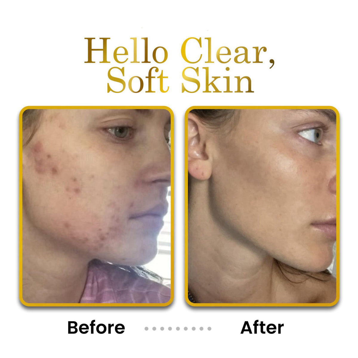 LUXEBEAUTY Luxe Cleanser All-in-One Hypoallergenic Face Cleanser + Natural Makeup Remover Face Wash + Exfoliator for All