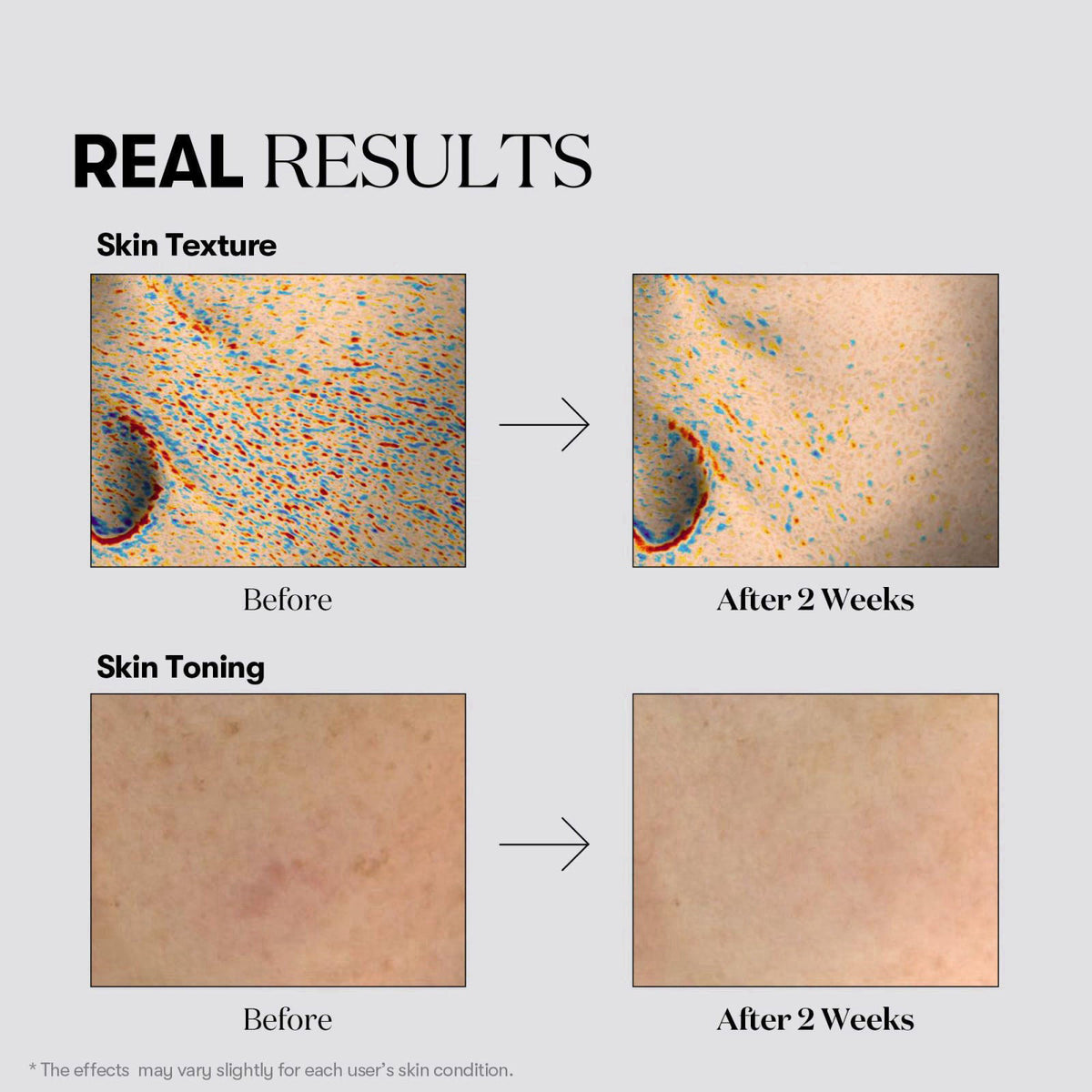 VT COSMETICS TX Toning Daily Mask 30 Sheets – full view