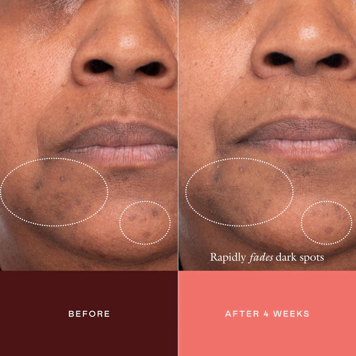 EADEM Advanced Dark Spot Concentrate Serum for Face with Tranexamic Acid – back view and specifications