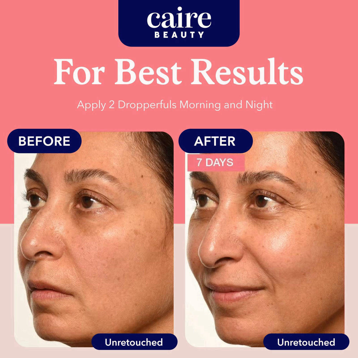 Caire 'Own Your Age' Hyaluronic Acid Collagen Serum, 15ml – alternate angle