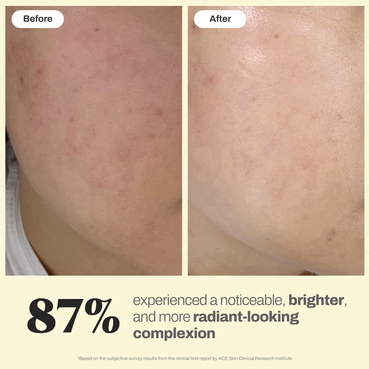 Aeluri Formula Brightening Glow Essence - Lightweight K Beauty Essence with Niacinamide, Tranexamic Acid, Glutathione, C