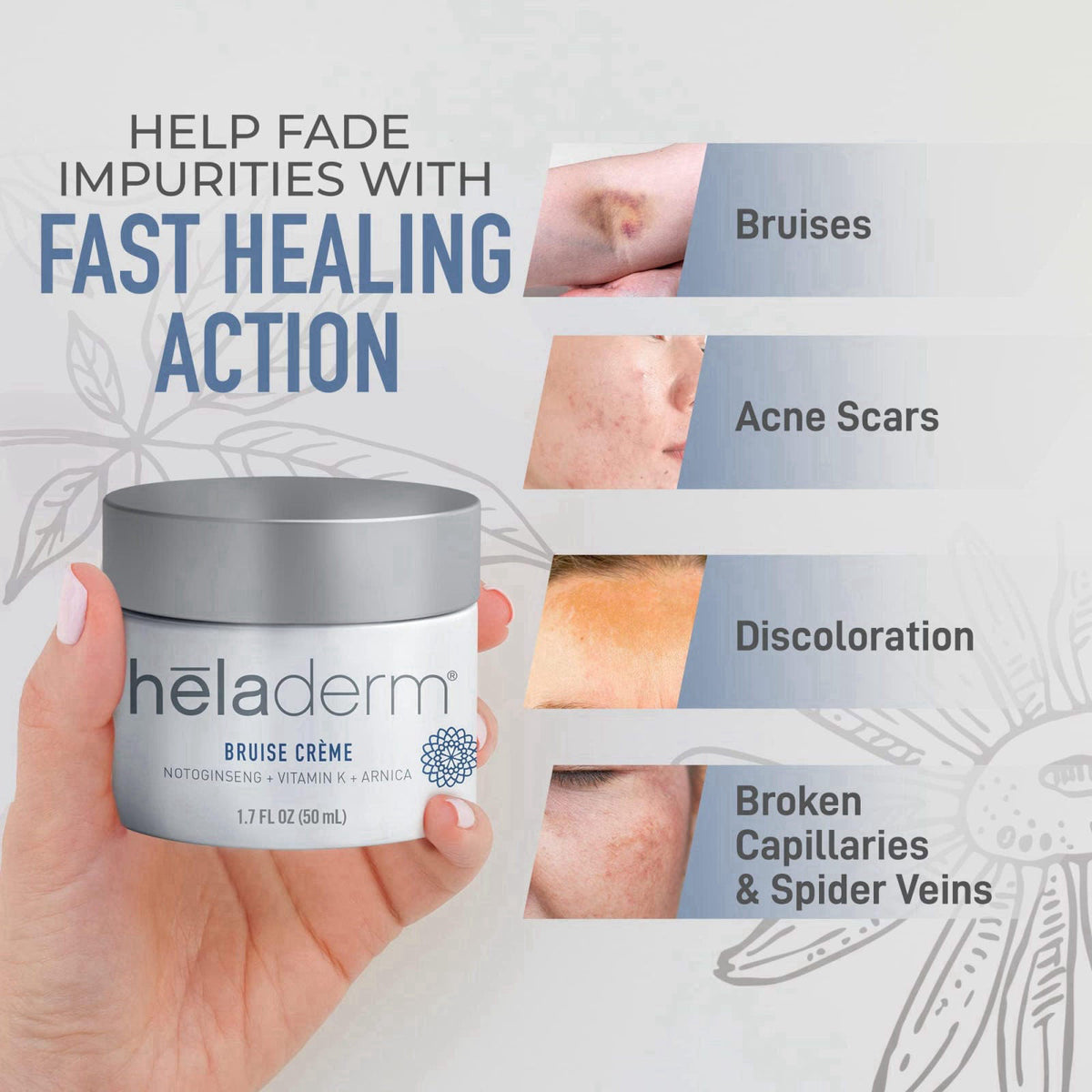 Heladerm Arnica Bruise Cream for Seniors with Extra Strength for Fast Healing - 50ml – alternate angle