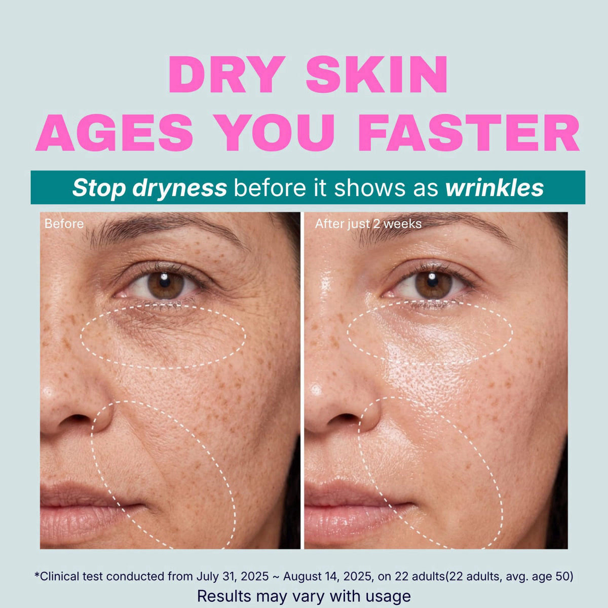 DEEPERCENT Blemish Serum for Dry Skin with PDRN, 8 Peptides, Panthenol – packaging and label