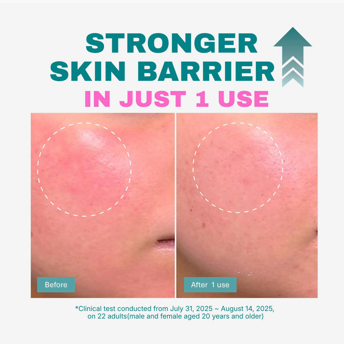DEEPERCENT Blemish Serum for Dry Skin with PDRN, 8 Peptides, Panthenol – alternate angle