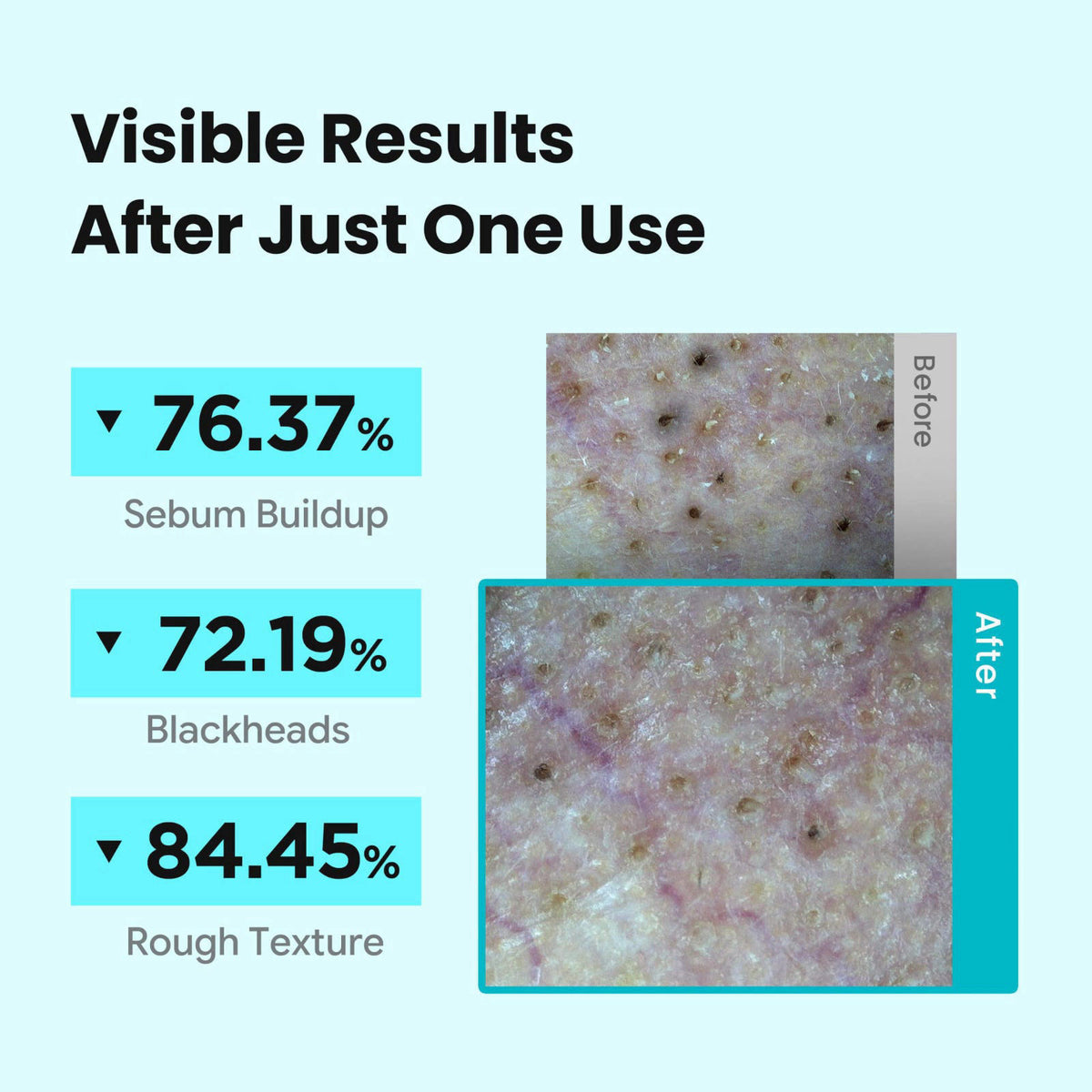 ILSO Melting Sebum Softener Cleanser 5.07 fl oz, Sebaceous Filament & Blackheads Care – back view and specifications