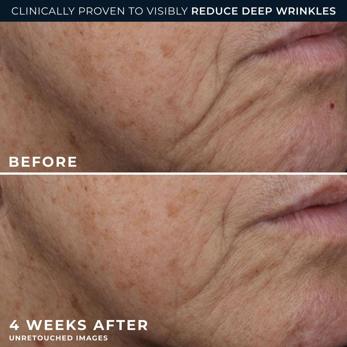 RoC Deep Wrinkle Rich Cream, Daily Anti-Aging Firming Cream, fragrance-free – back view and specifications