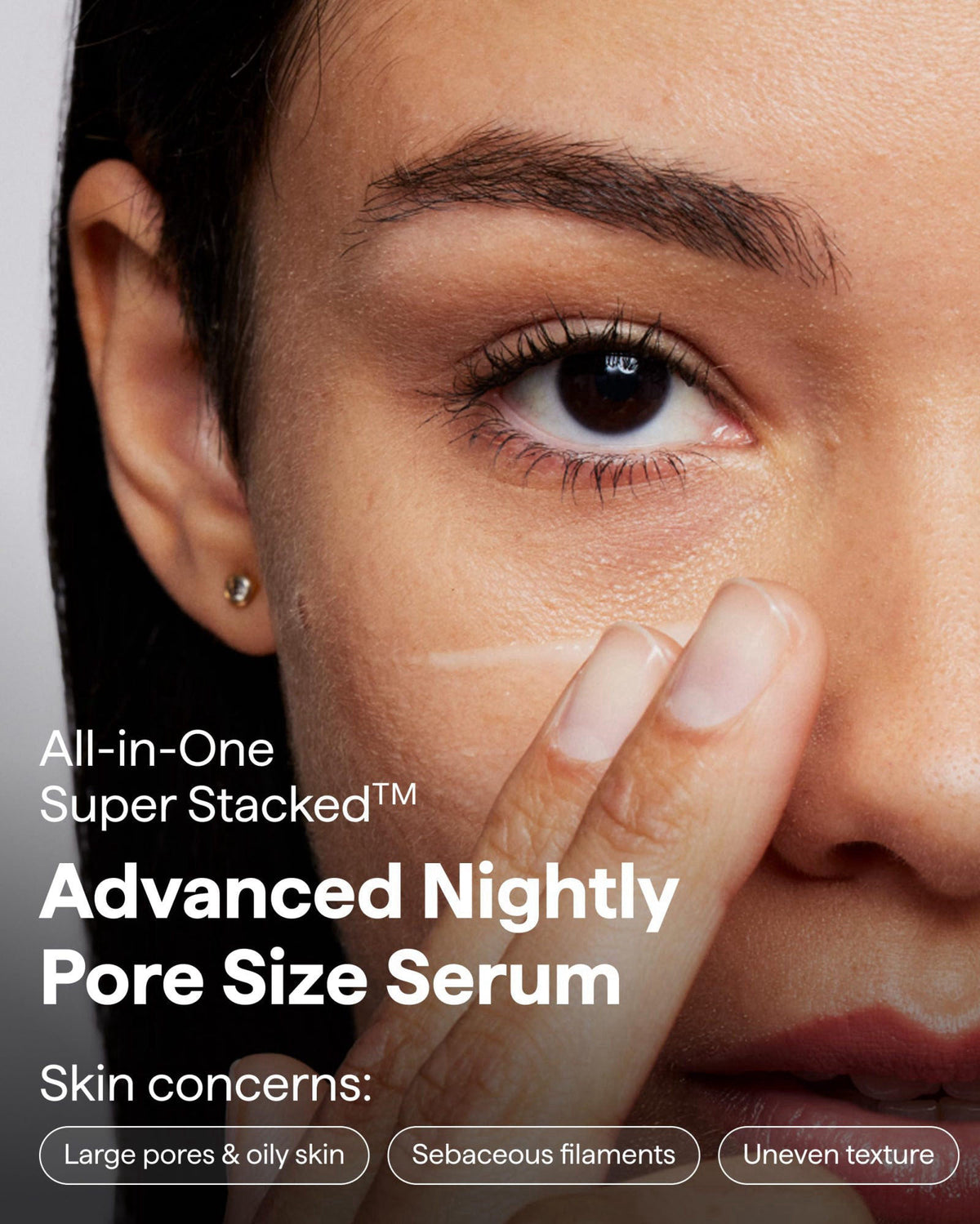 Remedy Science REMEDY for Pore Size, Pore Refining Advanced Serum for Blackheads & Pimple – close-up detail