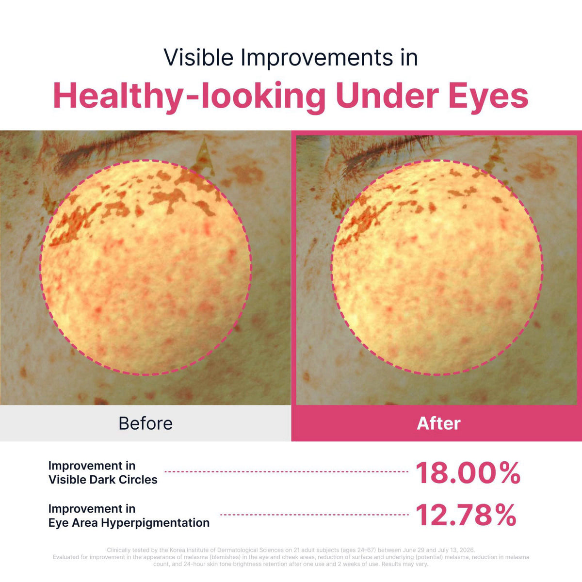 SUNGBOON EDITOR TXA Brightening Hydrogel Eye Patch – packaging and label