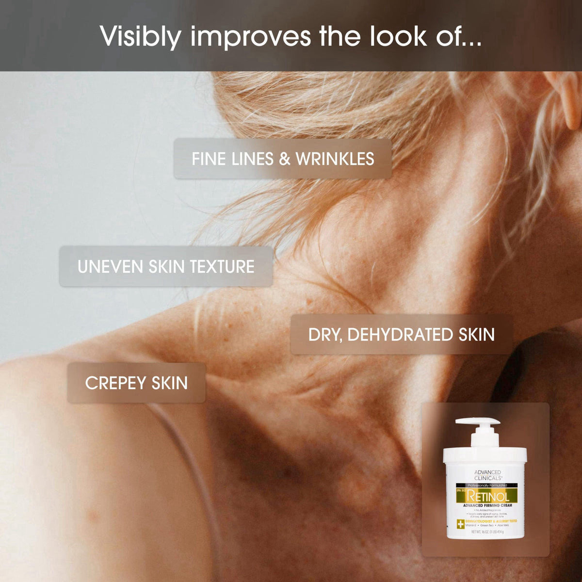 Advanced Clinicals Retinol Cream + Collagen Peptides Body Moisturizer & Face Lotion 2PC Skin Care Set | Dry Skin Body Lo