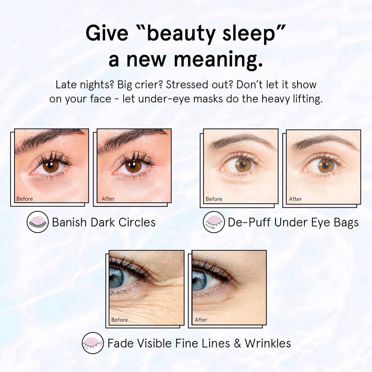 grace & stella Retinol Under Eye Patches for Wrinkles (Purple,24 Pairs) – full view