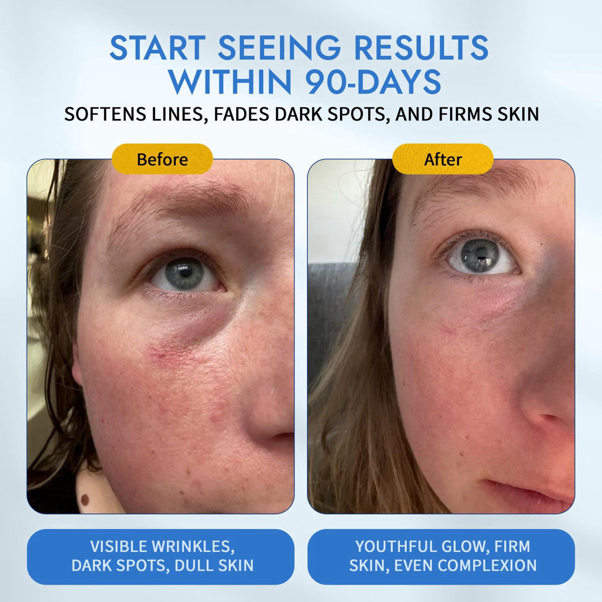 MAELOVE Moonlight Advanced Retinal Super Serum, 10x Stronger than Regular Retinol, for Softening Lines and Wrinkles, Red