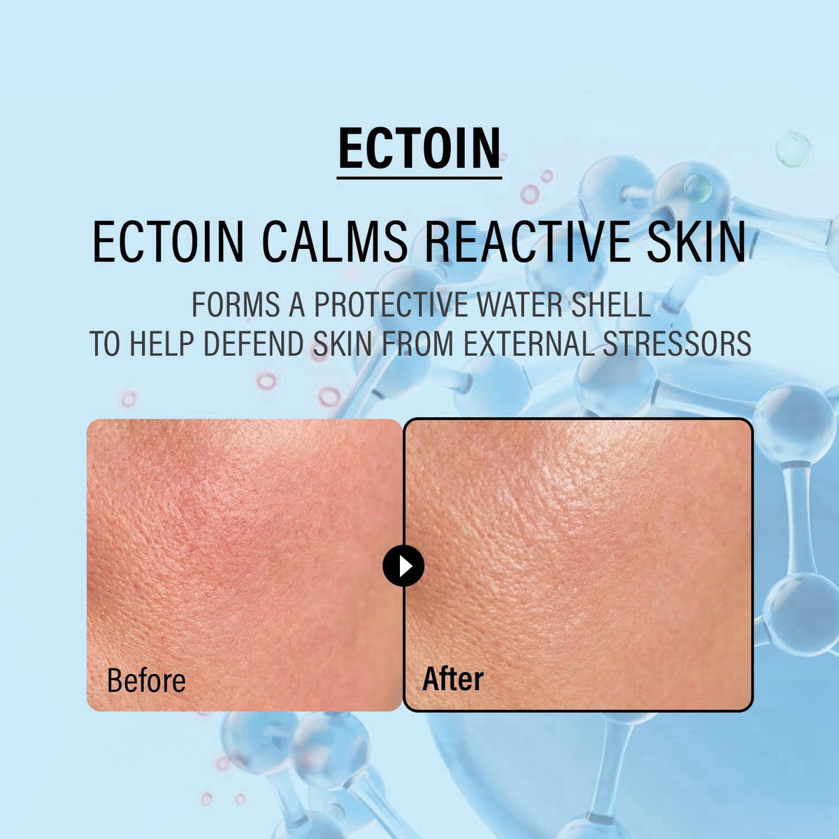 epii Double Up Cream - Ectoin Face Moisturizer with Panthenol & 15% Squalane - Korean Skincare Soothing Barrier Repair C