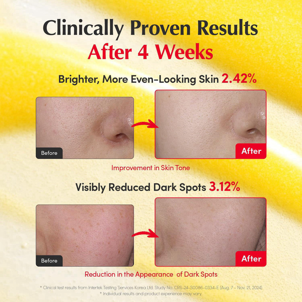 EQQUALBERRY Vitamin Illuminating Serum for Dark Spots & Brightening – full view