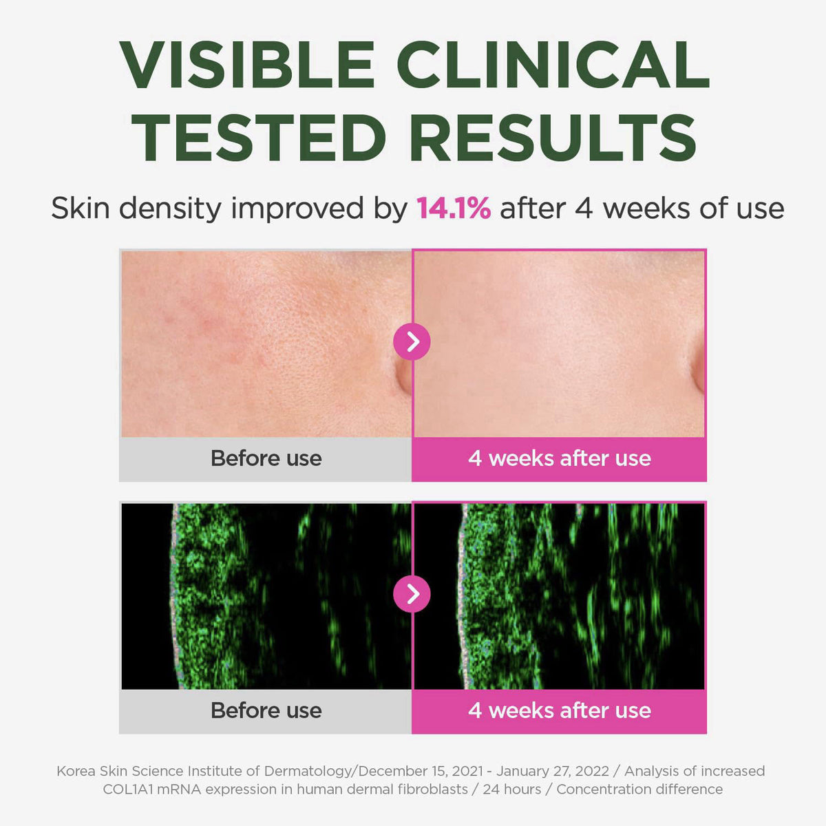 CKD Guaranteed CKD Retinal Collagen Pumping Ampoule (30 mL) – packaging and label