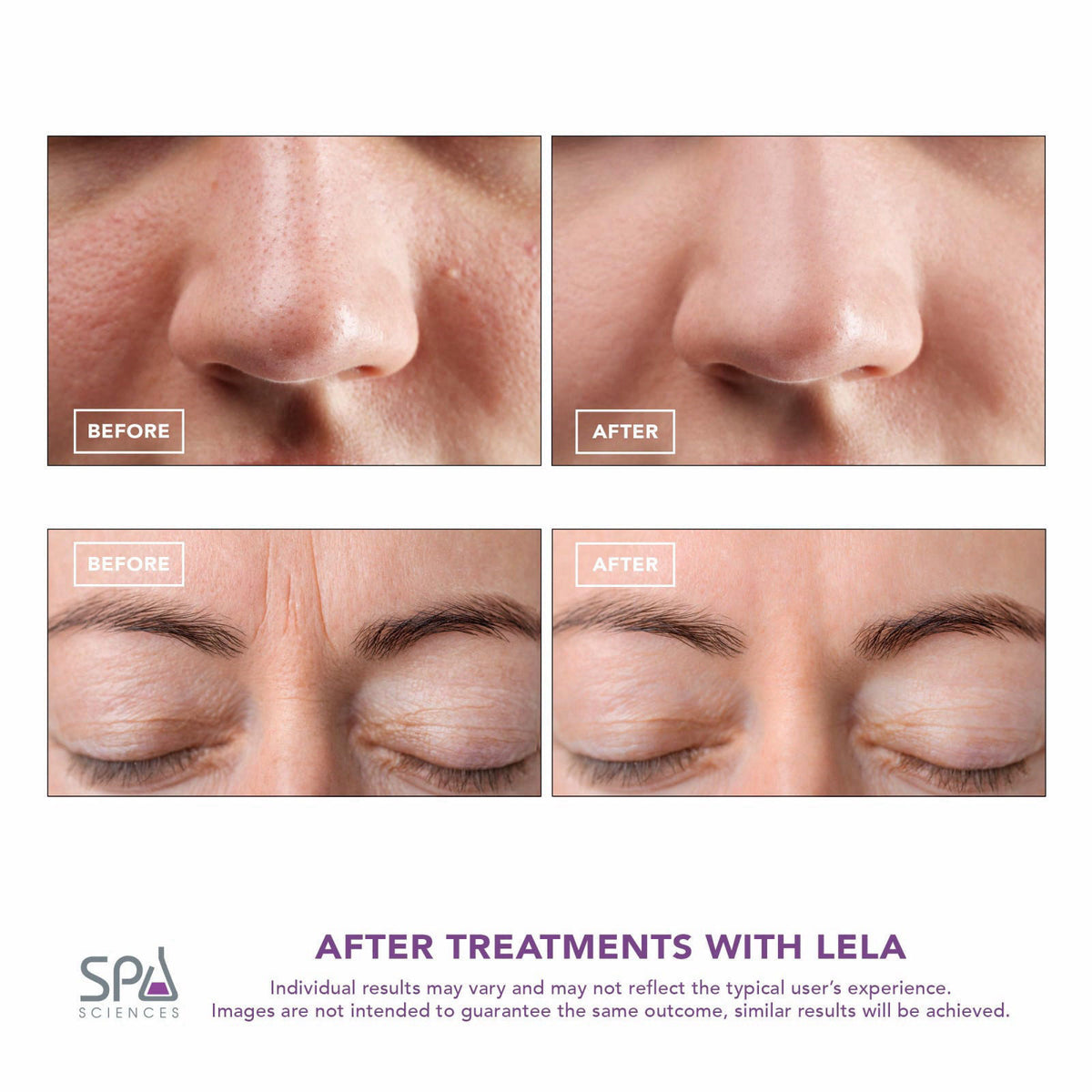 Spa Sciences - LELA - 4-in-1 Sonic Facial Spatula – full view