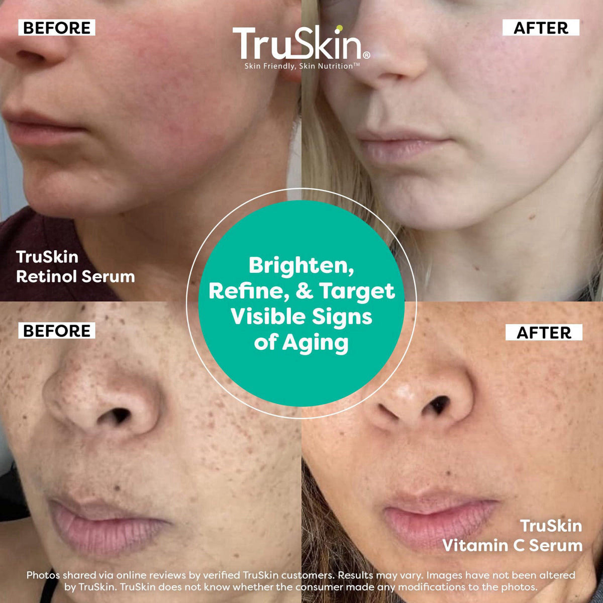 TruSkin Face Serum Duo - Vitamin C Serum & Retinol Serum for Face - AM & PM Anti Aging Skincare Routine - Brightening & 