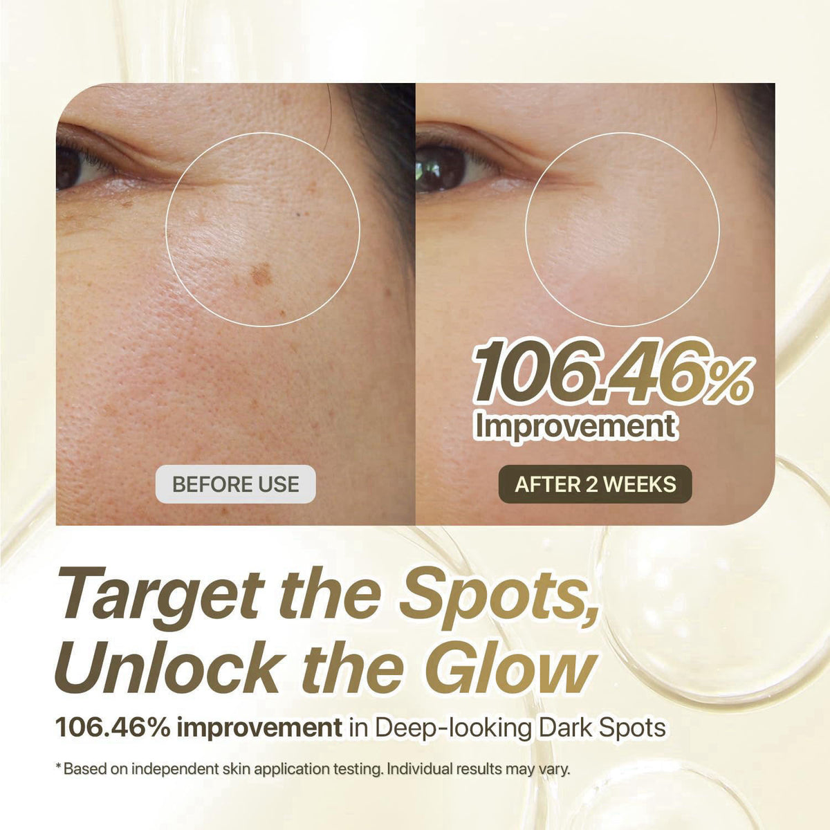 CHARDE 25% Niacinamide Dark Spot Serum for Radiant-Looking Skin – packaging and label