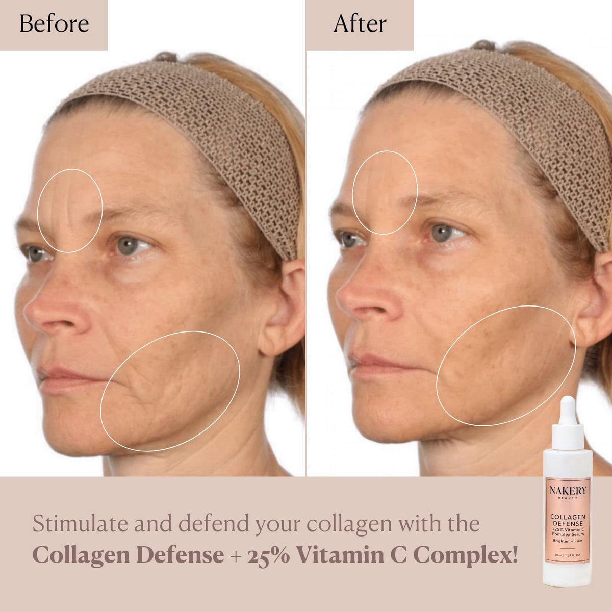Nakery Collagen Defense Face Serum, 25% Vitamin C Complex with Niacinamide and Peptides, Anti Aging Collagen Booster for