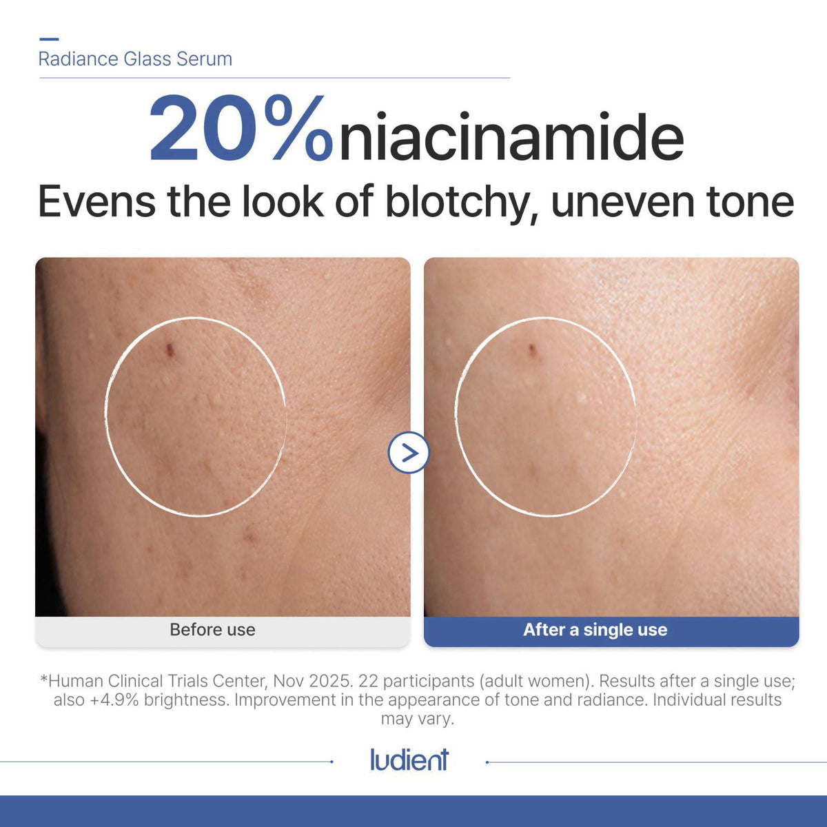 ludient Niacinamide, Glutathione Serum for Face, Dark Spot Corrector 1.69oz – full view
