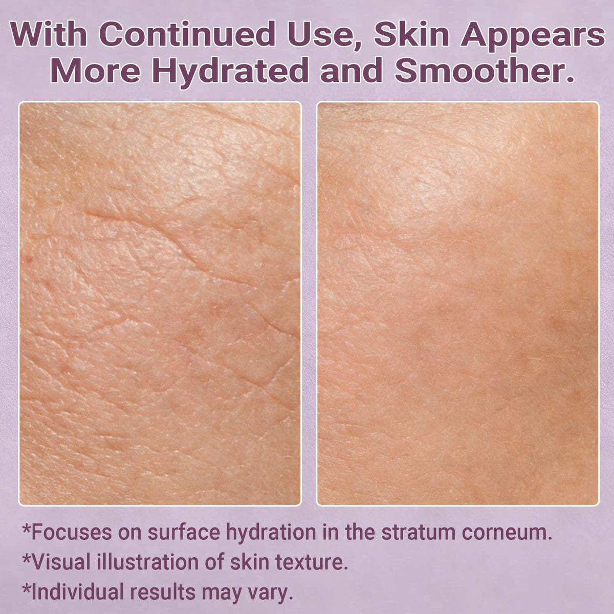 LANDISO NAD+, Bifida & Peptide Anti-Aging Moisturizer - 5 Botanical Extracts Soothing Repair Formula with Hyaluronic Aci